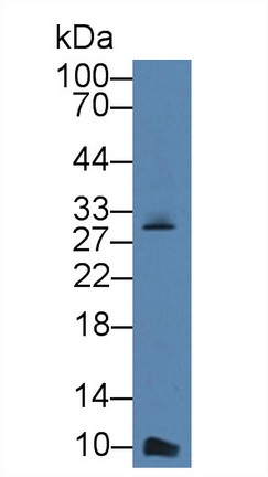 Western blot - Anti-CXCL7/PBP antibody (AB231102), expandable thumbnail