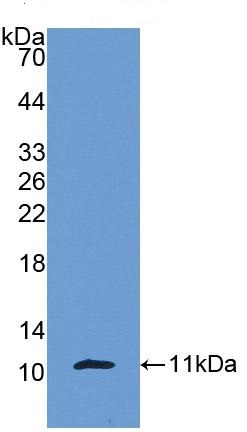 Western blot - Anti-CXCL7/PBP antibody (AB231102), expandable thumbnail