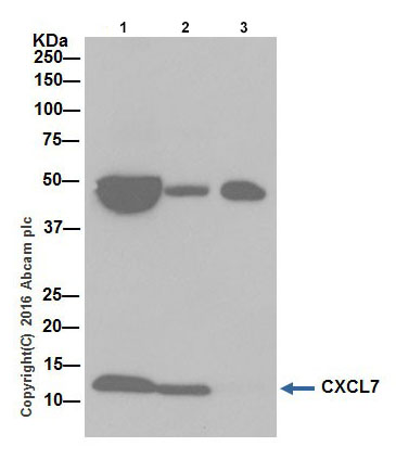 Immunoprecipitation - Anti-CXCL7/PBP antibody [EPR19780] (AB206966), expandable thumbnail