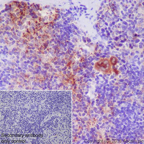 Immunohistochemistry (Formalin/PFA-fixed paraffin-embedded sections) - Anti-CXCL7/PBP antibody [EPR20036] (AB206406)