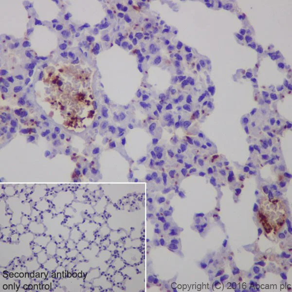 Immunohistochemistry (Formalin/PFA-fixed paraffin-embedded sections) - Anti-CXCL7/PBP antibody [EPR20036] - BSA and Azide free (AB251455)