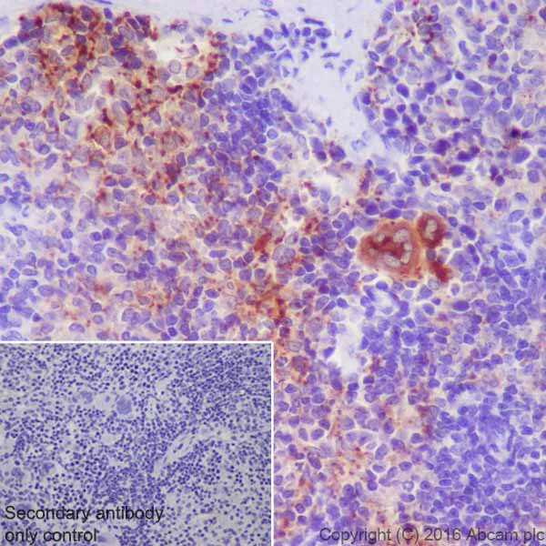 Immunohistochemistry (Formalin/PFA-fixed paraffin-embedded sections) - Anti-CXCL7/PBP antibody [EPR20036] - BSA and Azide free (AB251455)