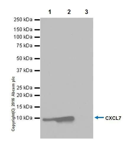 Immunoprecipitation - Anti-CXCL7/PBP antibody [EPR20036] - BSA and Azide free (AB251455)