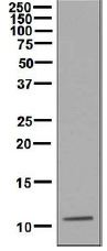 Western blot - Anti-CXCL7/PBP antibody [EPR7767] (AB133252)