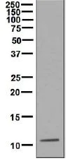 Western blot - Anti-CXCL7/PBP antibody [EPR7767] (AB133252)