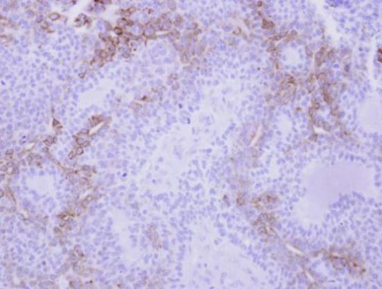 Immunohistochemistry (Formalin/PFA-fixed paraffin-embedded sections) - Anti-CXCL9 antibody (AB137792), expandable thumbnail