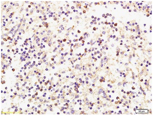 Immunohistochemistry (Formalin/PFA-fixed paraffin-embedded sections) - Anti-CXCL9 antibody (AB202961)