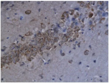 Immunohistochemistry (Formalin/PFA-fixed paraffin-embedded sections) - Anti-CXCL9 antibody (AB202961)