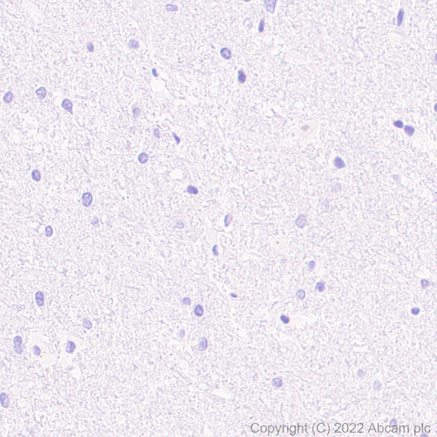 Immunohistochemistry (Formalin/PFA-fixed paraffin-embedded sections) - Anti-CXCL9 antibody [EPR26512-118] - BSA and Azide free (ab290654), expandable thumbnail