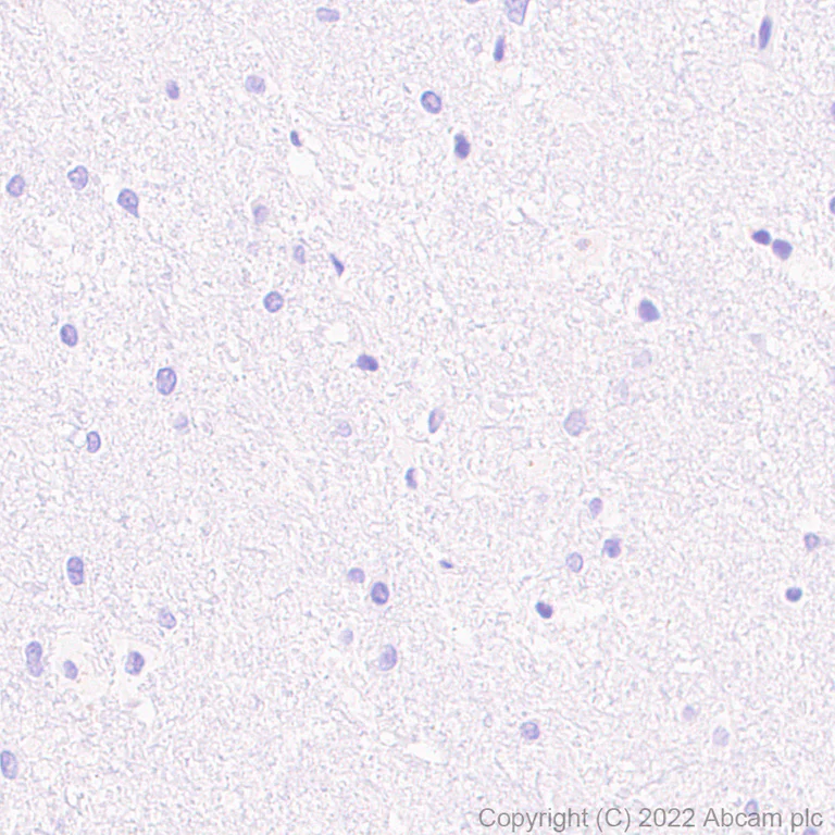 Immunohistochemistry (Formalin/PFA-fixed paraffin-embedded sections) - Anti-CXCL9 antibody [EPR26512-118] - BSA and Azide free (AB290654)