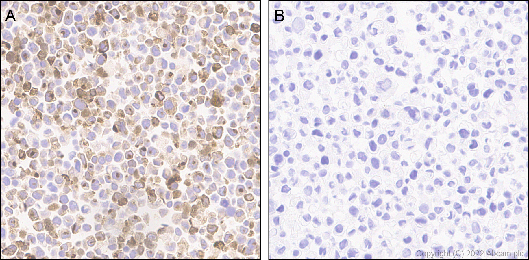 Immunohistochemistry (Formalin/PFA-fixed paraffin-embedded sections) - Anti-CXCL9 antibody [EPR26512-118] - BSA and Azide free (ab290654), expandable thumbnail