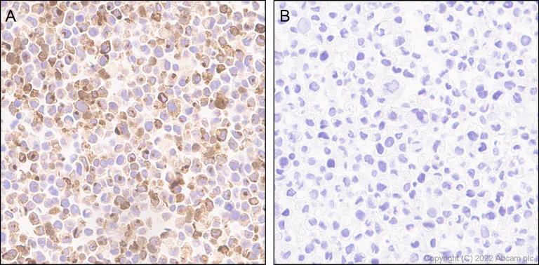 Immunohistochemistry (Formalin/PFA-fixed paraffin-embedded sections) - Anti-CXCL9 antibody [EPR26512-118] - BSA and Azide free (AB290654)