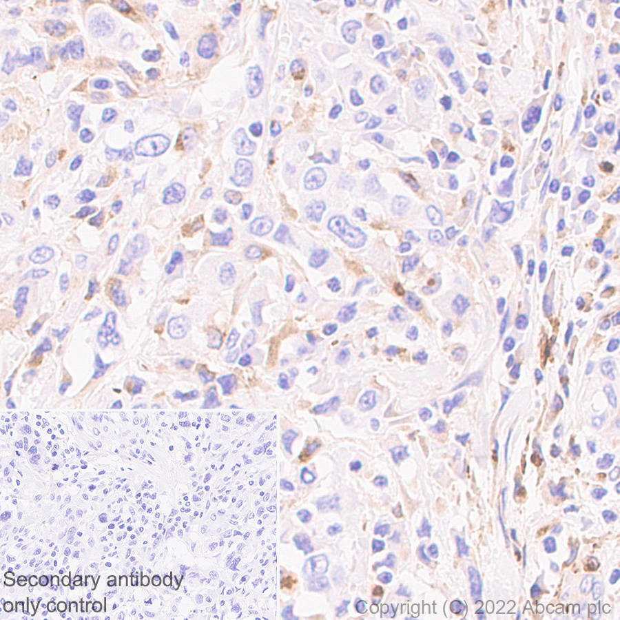 Immunohistochemistry (Formalin/PFA-fixed paraffin-embedded sections) - Anti-CXCL9 antibody [EPR26512-118] - BSA and Azide free (AB290654), expandable thumbnail