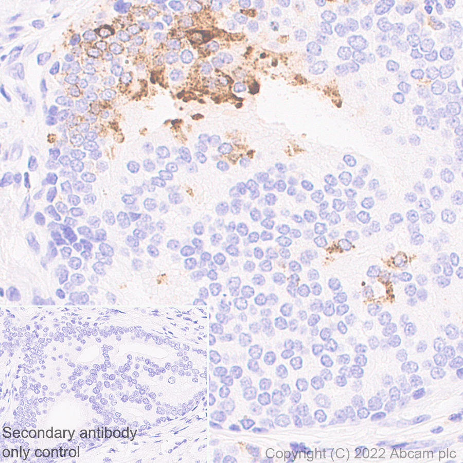 Immunohistochemistry (Formalin/PFA-fixed paraffin-embedded sections) - Anti-CXCL9 antibody [EPR26512-118] - BSA and Azide free (AB290654), expandable thumbnail