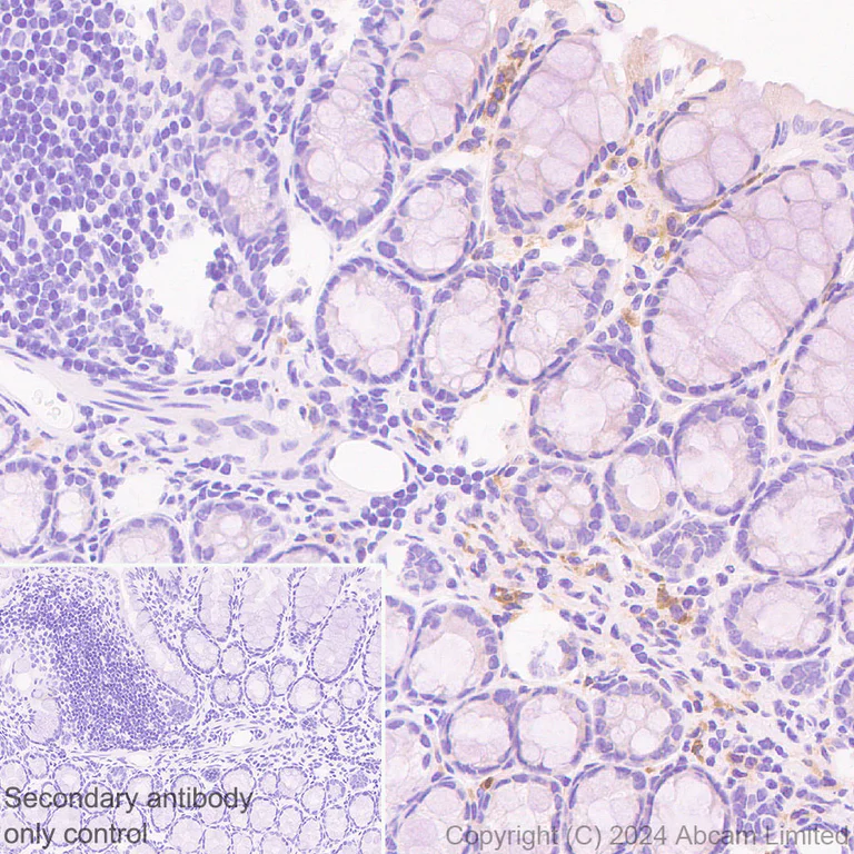 Immunohistochemistry (Formalin/PFA-fixed paraffin-embedded sections) - Anti-CXCL9 antibody [EPR28968-26] (AB320827)