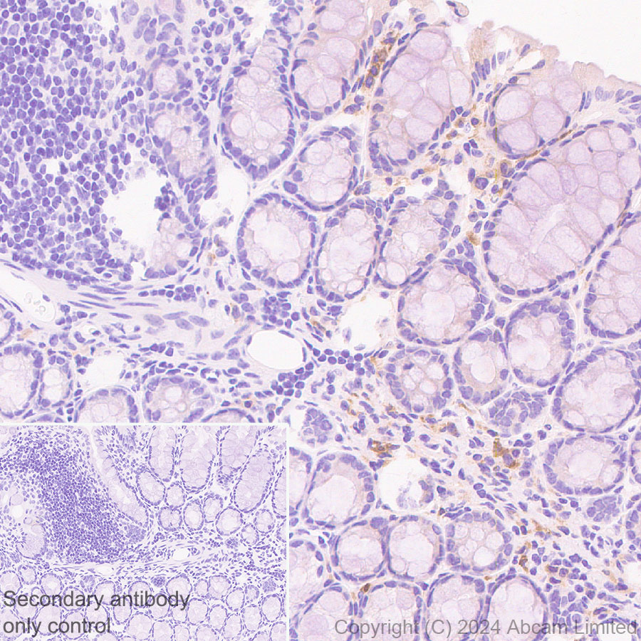 Immunohistochemistry (Formalin/PFA-fixed paraffin-embedded sections) - Anti-CXCL9 antibody [EPR28968-26] - BSA and Azide free (AB320828), expandable thumbnail