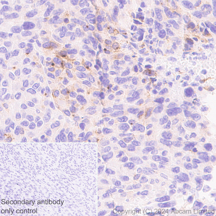 Immunohistochemistry (Formalin/PFA-fixed paraffin-embedded sections) - Anti-CXCL9 antibody [EPR28968-26] - BSA and Azide free (AB320828), expandable thumbnail