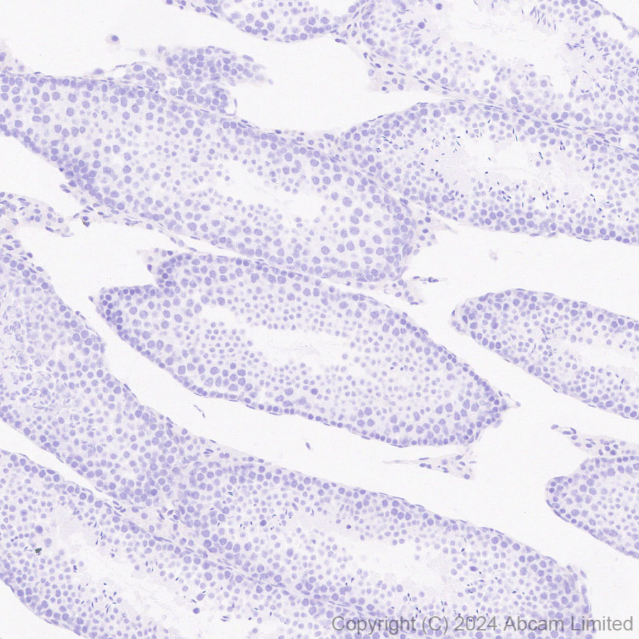 Immunohistochemistry (Formalin/PFA-fixed paraffin-embedded sections) - Anti-CXCL9 antibody [EPR28968-26] - BSA and Azide free (AB320828), expandable thumbnail
