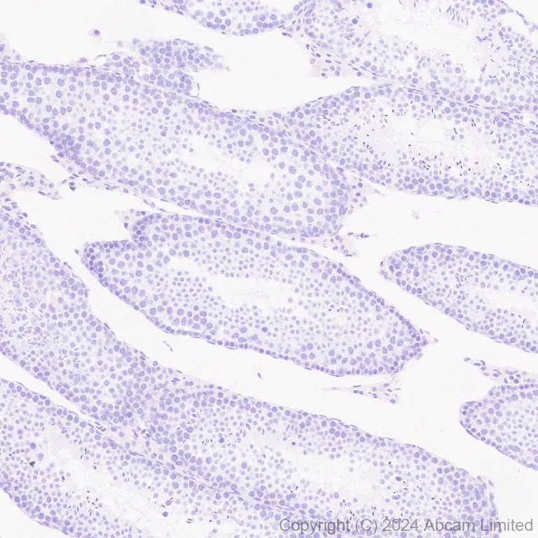 Immunohistochemistry (Formalin/PFA-fixed paraffin-embedded sections) - Anti-CXCL9 antibody [EPR28968-26] - BSA and Azide free (AB320828)