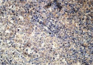 Immunohistochemistry (Formalin/PFA-fixed paraffin-embedded sections) - Anti-CXCR1 antibody (AB124344)