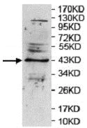 Western blot - Anti-CXCR1 antibody (AB124344)