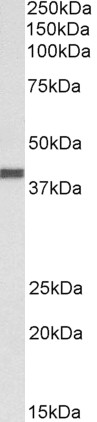 Western blot - Anti-CXCR1 antibody (AB195985), expandable thumbnail