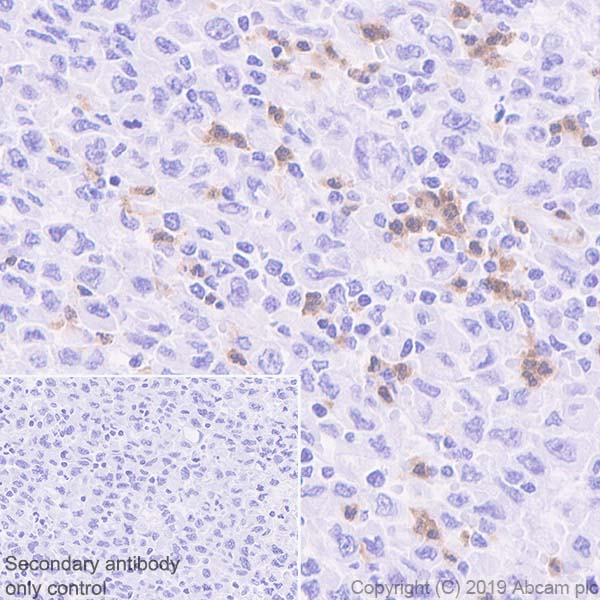 Immunohistochemistry (Formalin/PFA-fixed paraffin-embedded sections) - Anti-CXCR2 antibody [EPR22301-103] (AB225732)