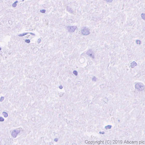 Immunohistochemistry (Formalin/PFA-fixed paraffin-embedded sections) - Anti-CXCR2 antibody [EPR22301-103] - BSA and Azide free (AB245982)