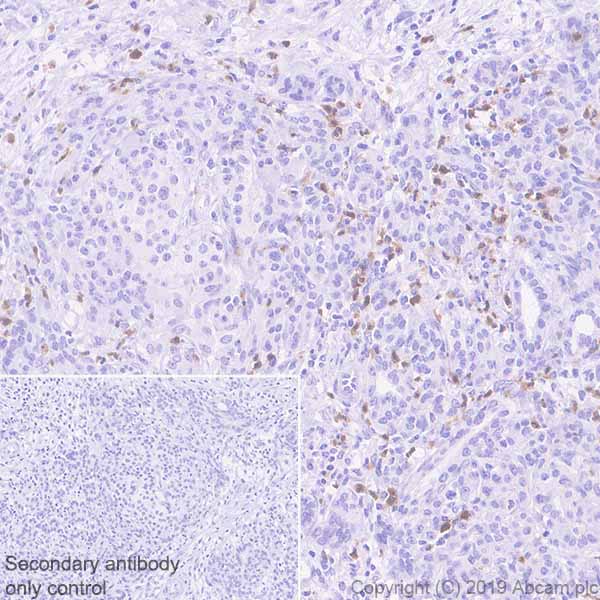 Immunohistochemistry (Formalin/PFA-fixed paraffin-embedded sections) - Anti-CXCR2 antibody [EPR22301-103] - BSA and Azide free (AB245982)