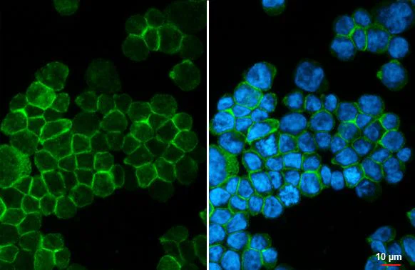 Immunocytochemistry/ Immunofluorescence - Anti-CXCR2 antibody [HL2604] - BSA and Azide free (AB325849)