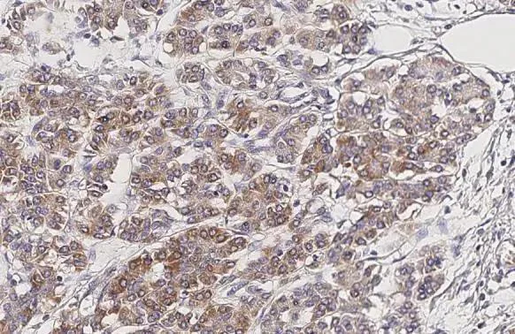 Immunohistochemistry (Formalin/PFA-fixed paraffin-embedded sections) - Anti-CXCR2 antibody [HL2604] - BSA and Azide free (AB325849)