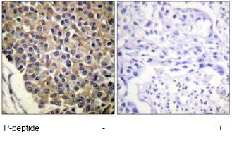 Immunohistochemistry (Formalin/PFA-fixed paraffin-embedded sections) - Anti-CXCR2 (phospho S347) antibody (AB61100)