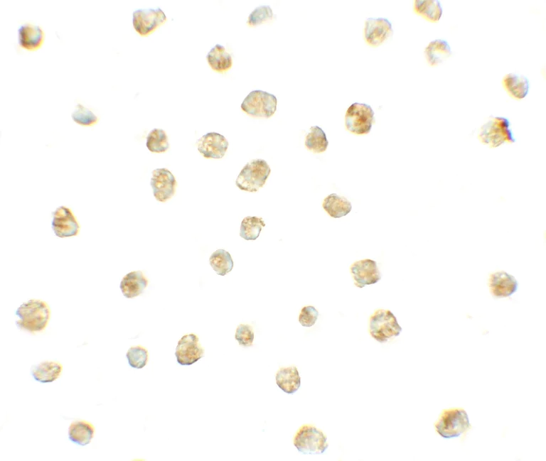 Immunocytochemistry/ Immunofluorescence - Anti-CXCR3 antibody - C-terminal (AB181013)