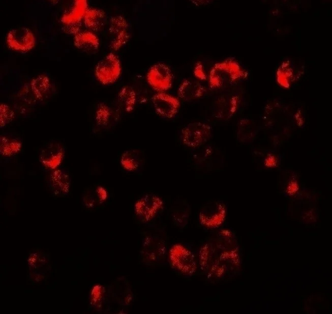 Immunocytochemistry/ Immunofluorescence - Anti-CXCR3 antibody - C-terminal (AB181013)