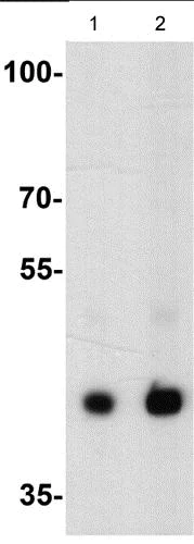 Western blot - Anti-CXCR3 antibody - C-terminal (AB181013)