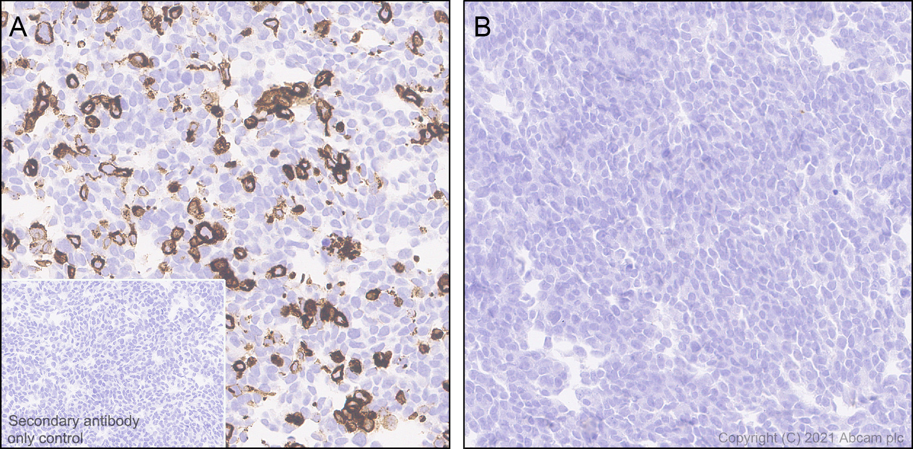 Immunohistochemistry (Formalin/PFA-fixed paraffin-embedded sections) - Anti-CXCR3 antibody [EPR25373-32] (AB288437), expandable thumbnail