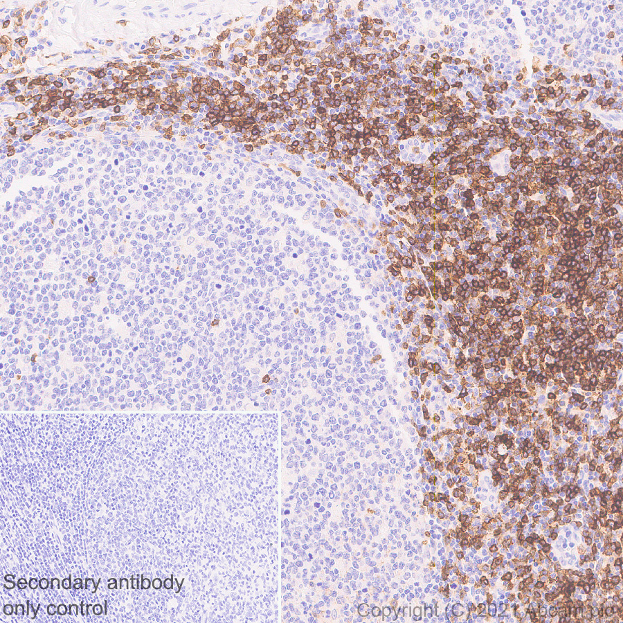 Immunohistochemistry (Formalin/PFA-fixed paraffin-embedded sections) - Anti-CXCR3 antibody [EPR25373-32] (ab288437), expandable thumbnail
