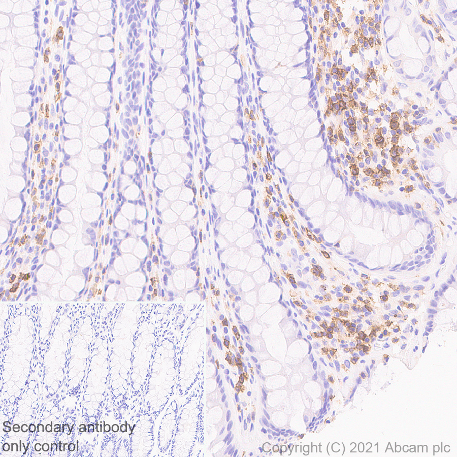 Immunohistochemistry (Formalin/PFA-fixed paraffin-embedded sections) - Anti-CXCR3 antibody [EPR25373-32] (ab288437), expandable thumbnail