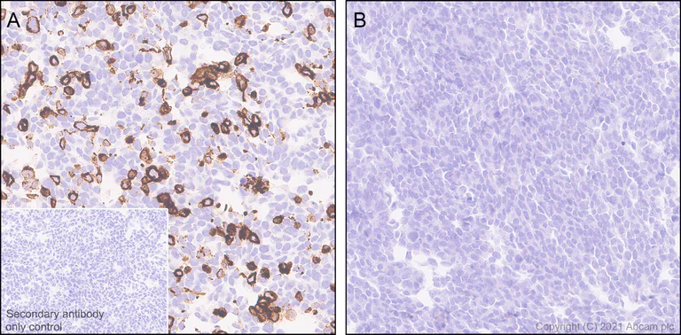 Immunohistochemistry (Formalin/PFA-fixed paraffin-embedded sections) - Anti-CXCR3 antibody [EPR25373-32] - BSA and Azide free (AB288446)
