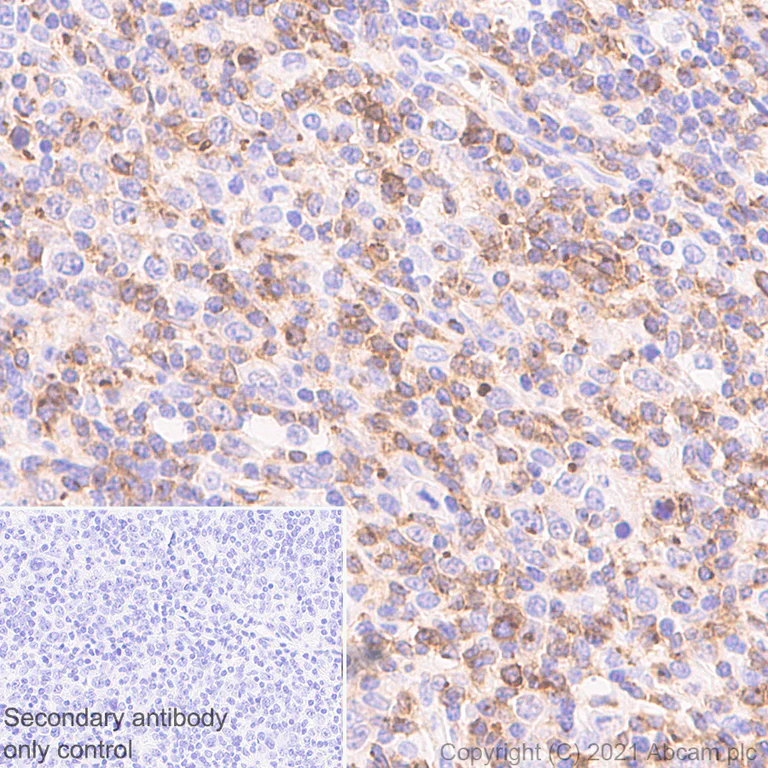 Immunohistochemistry (Formalin/PFA-fixed paraffin-embedded sections) - Anti-CXCR3 antibody [EPR25373-32] - BSA and Azide free (AB288446)