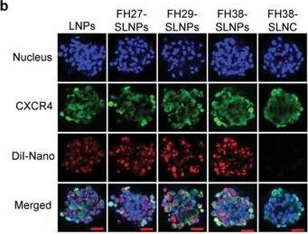 Immunocytochemistry/ Immunofluorescence - Anti-CXCR4 antibody [EPUMBR3] (AB181020)