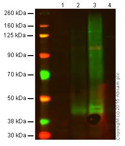 Western blot - Anti-CXCR4 antibody [EPUMBR3] (AB181020)
