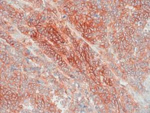 Immunohistochemistry (Formalin/PFA-fixed paraffin-embedded sections) - Anti-CXCR4 antibody [EPUMBR3] - BSA and Azide free (AB271934)
