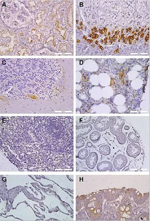 Immunohistochemistry (Formalin/PFA-fixed paraffin-embedded sections) - Anti-CXCR4 antibody [UMB2] (AB124824)