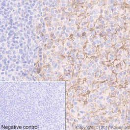 Immunohistochemistry (Formalin/PFA-fixed paraffin-embedded sections) - Anti-CXCR4/CD184 antibody [UMB2] (AB124824)