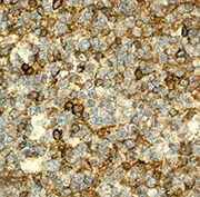 Immunohistochemistry (Formalin/PFA-fixed paraffin-embedded sections) - Anti-CXCR4 antibody [UMB2] (AB124824)