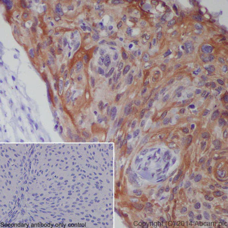 Immunohistochemistry (Formalin/PFA-fixed paraffin-embedded sections) - Anti-CXCR4 antibody [UMB2] (AB124824)
