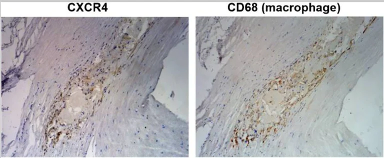 Immunohistochemistry (Formalin/PFA-fixed paraffin-embedded sections) - Anti-CXCR4 antibody [UMB2] (AB124824)