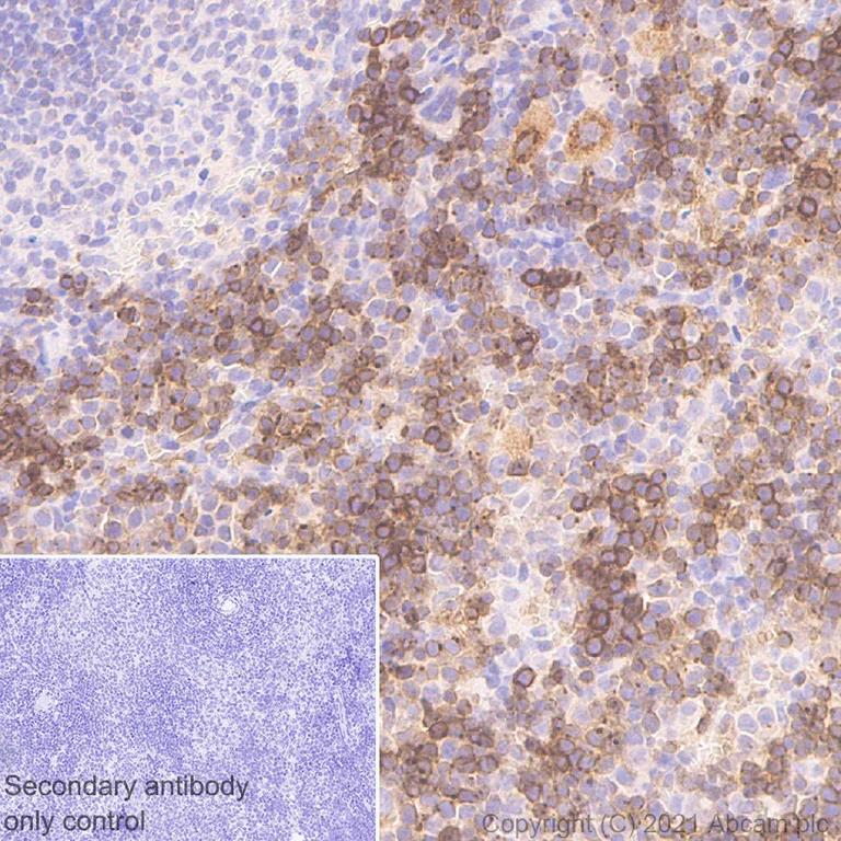 Immunohistochemistry (Formalin/PFA-fixed paraffin-embedded sections) - Anti-CXCR4 antibody [UMB2] (AB124824)