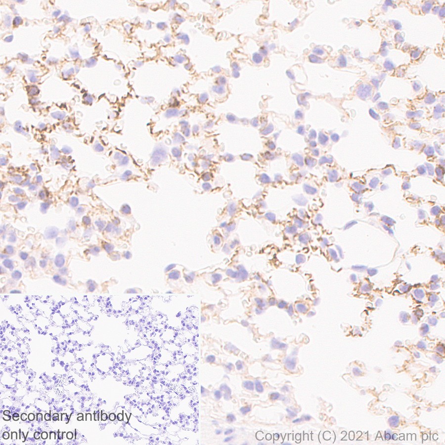 Immunohistochemistry (Formalin/PFA-fixed paraffin-embedded sections) - Anti-CXCR4 antibody [UMB2] (ab124824), expandable thumbnail